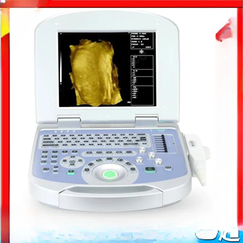 For B-ultrasound machine, B-ultrasound machine, B-ultrasound instrument, B-ultrasound animal medical B-ultrasound machine