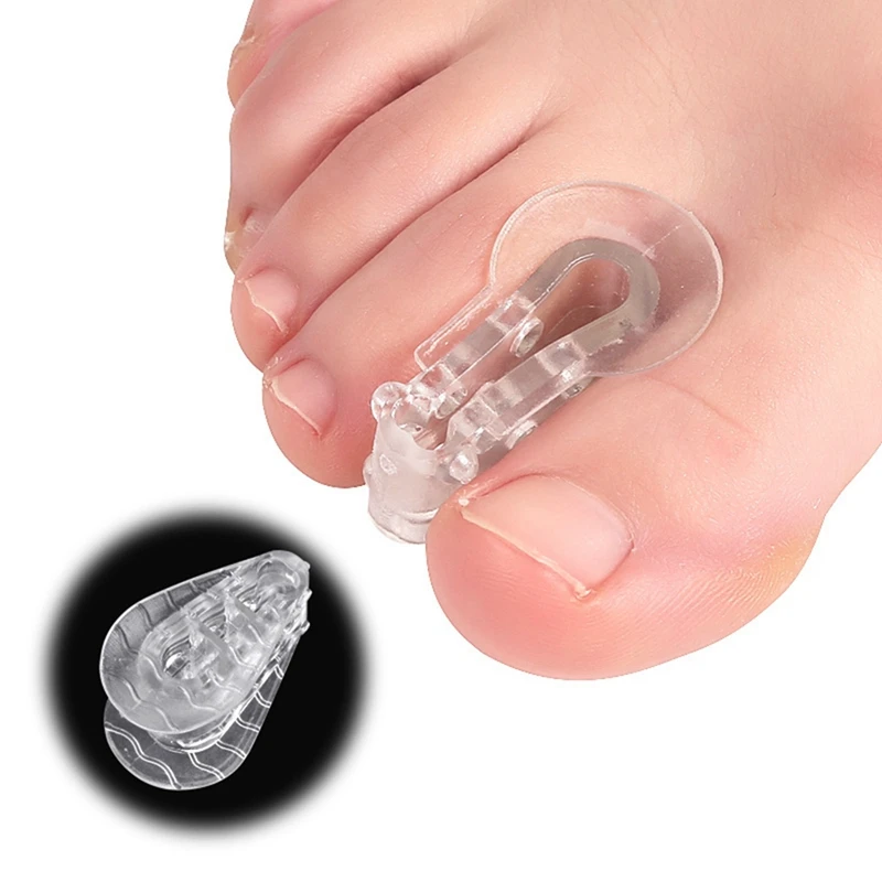 Separadores de juanete, Corrector ortopédico de Gel para juanetes, dedos superpuestos, Hallux Valgus, 3,5X2Cm, 10 paquetes