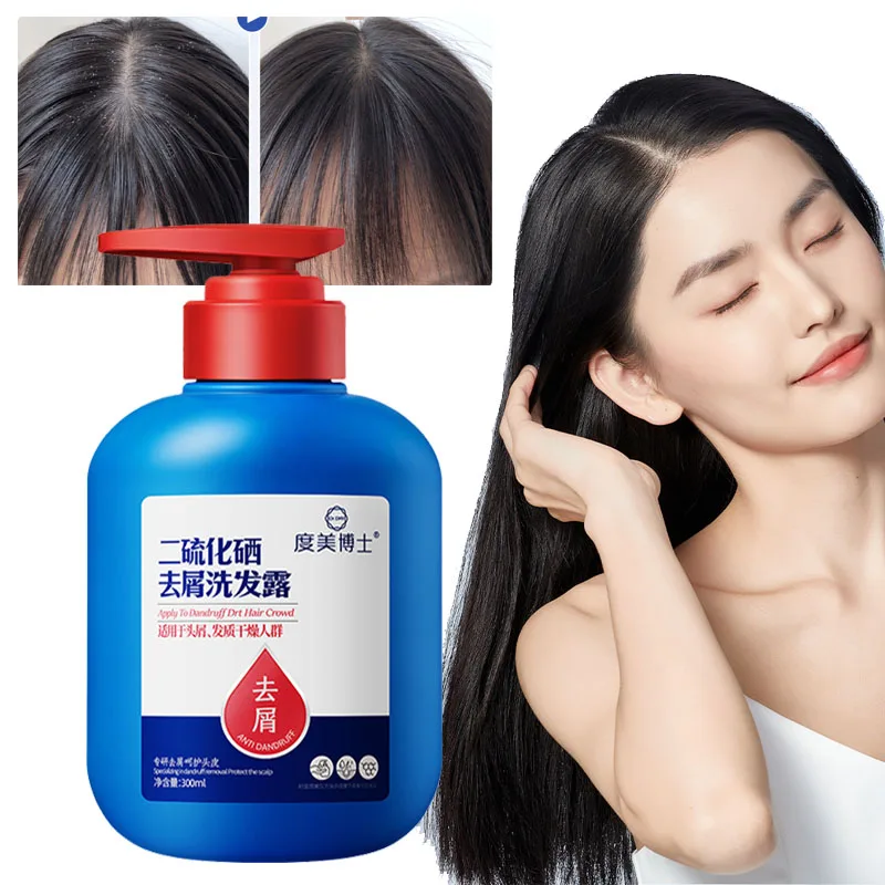 Selenium Sulfide Anti-dandruff and Anti-itch Shampoo MoisturizingScalp Oil Control Cleansing and Mite Removal Refreshing Shampoo