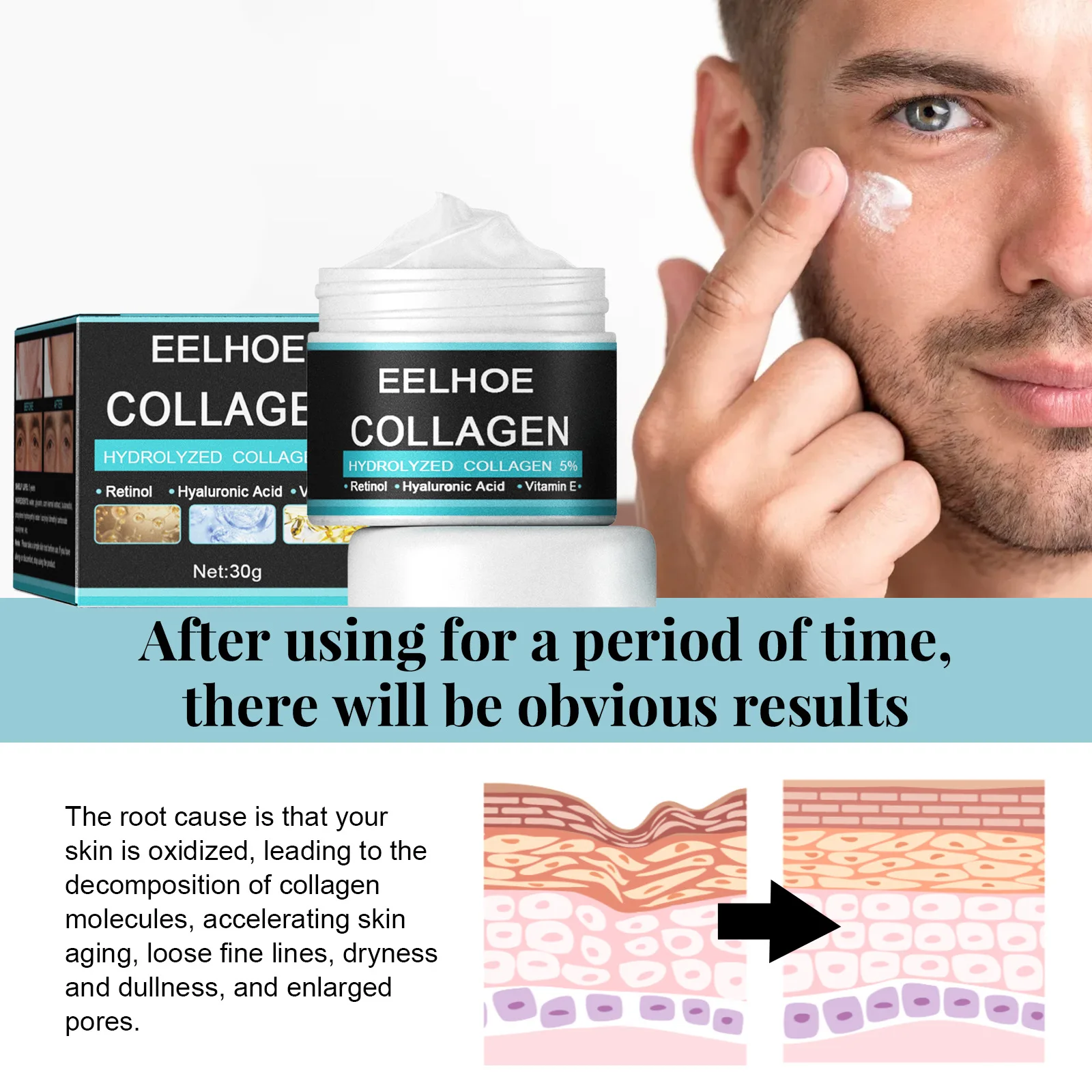 EELHOE Vitamin E Moisturizing Cream Man Improve Rough Dry Skin Tightening Nourishing Retinol Rejuvenate the Face Cream Man 50g