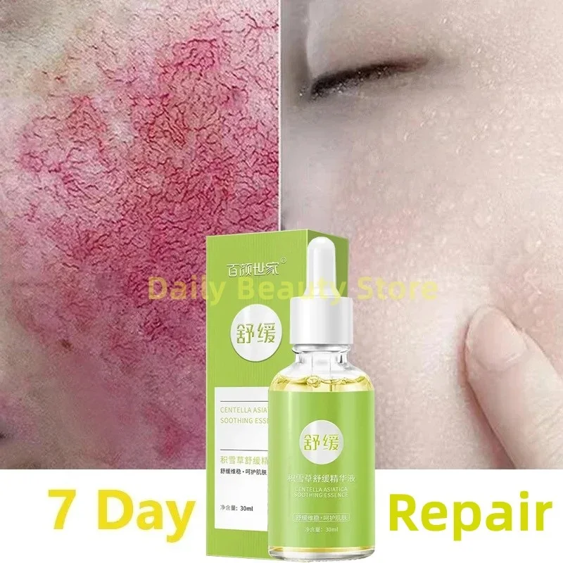 7 Day Repair Redness Serum Sooth Itching Sensitive Skin Improve Rosacea Shrink Pore Smooth Nourish Facial Skin Korean Cosmetics