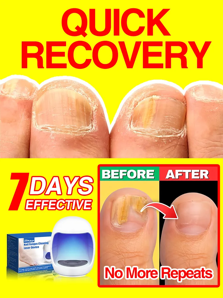 

Solves all nail problems