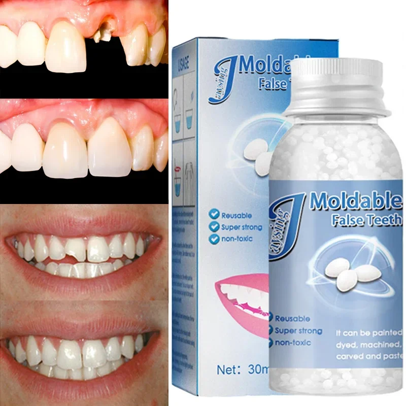 10/20/30ml cuentas de reparación de dientes temporales faltantes dientes rotos dentales moldeables dentadura postiza relleno herramientas para dientes postizos 1 ud.