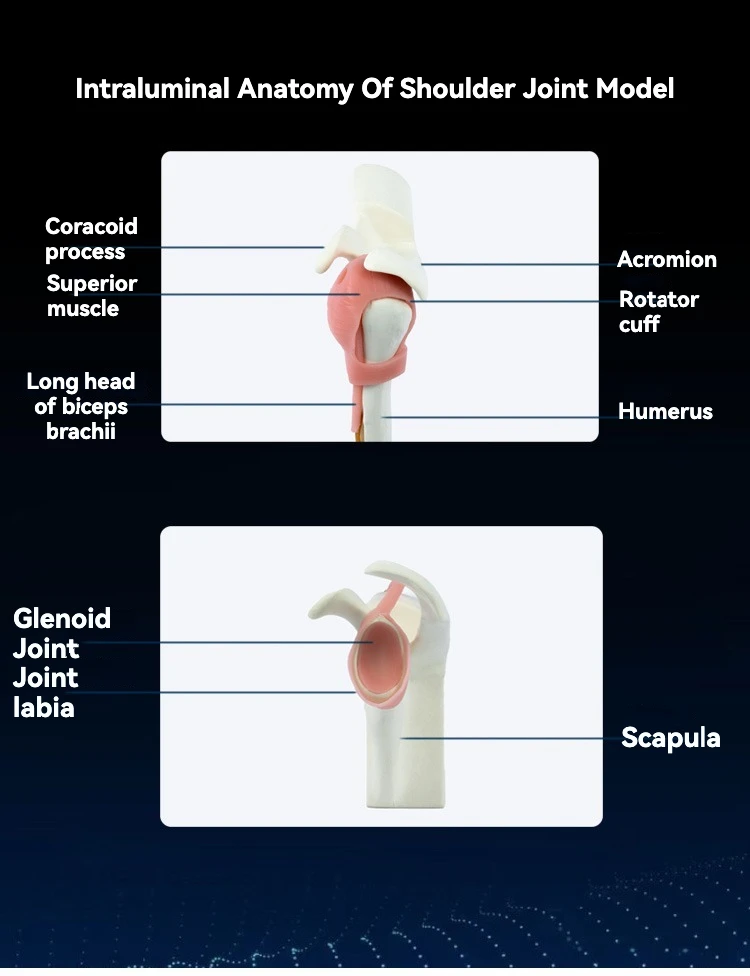 Shoulder Arthroscopic Surgery Simulation Model with Pliers for Dry Model Shoulder Surgery Training Emulator