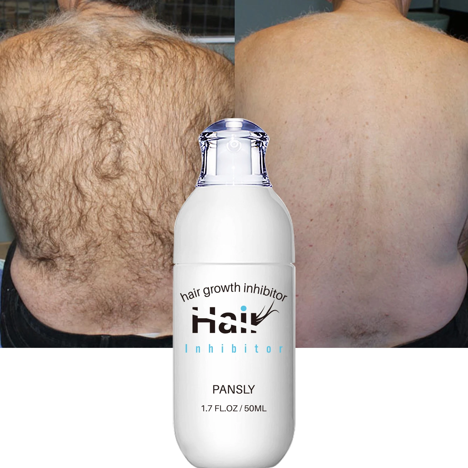 100ML Hair Removal Spray Hair Growth Inhibitor Spray Painless Hair Reduction Permanently Inhibits Hair Growth Skin Silky Smooth