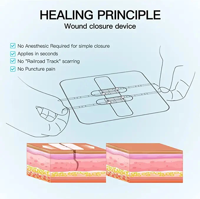 2PCS Zip Stitch Sutures BAND Kit Waterproof Strips Wound Closure Hospital Grade Laceration Kit  Painless Deco Band Aid