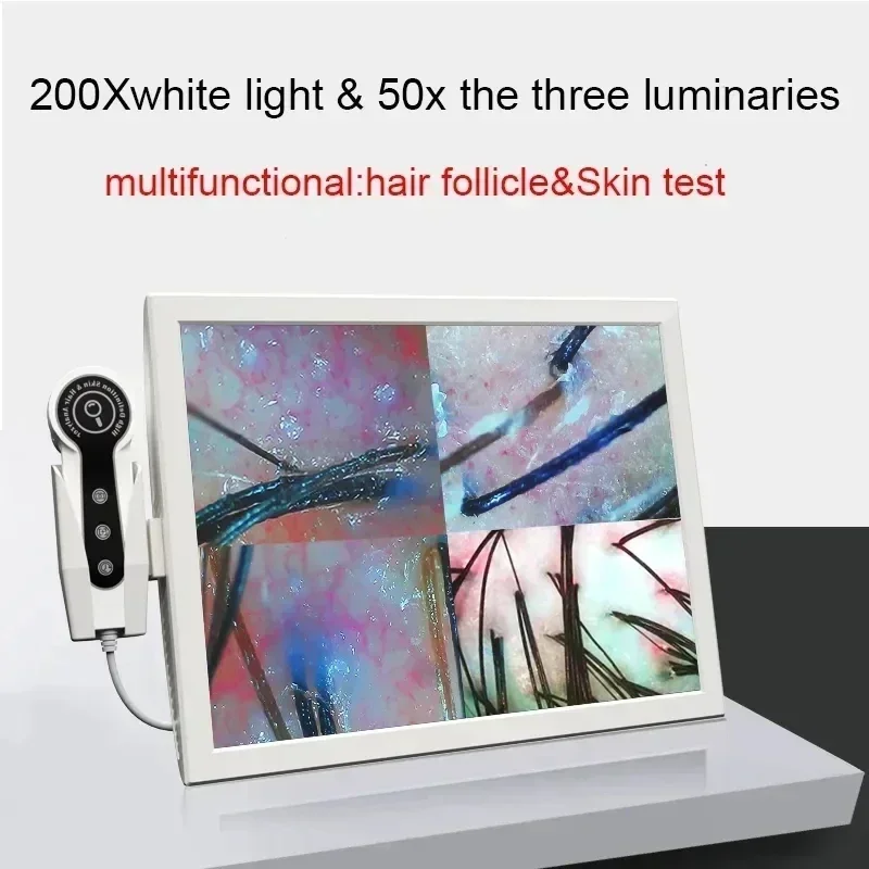 15 Inch Screen Ultra Hair Skin Analyze HD Intelligent Beauty Salon Home 50/200 Times Lens HD Scalp Hair Detector Skin Analysis