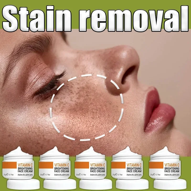 

Whitening and freckle removal cream Artifacts Age spot face black spot removal skin care face