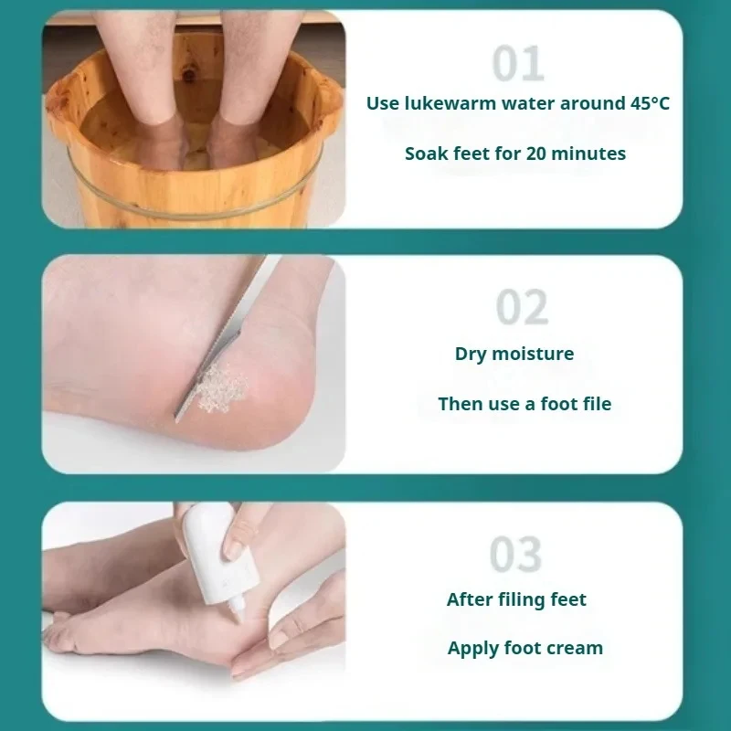 Foot Callus Remover Set 1/2/5PCS, Pedicure Knife, Dead Skin Scraper, Corn Shaver, Foot Care Tool