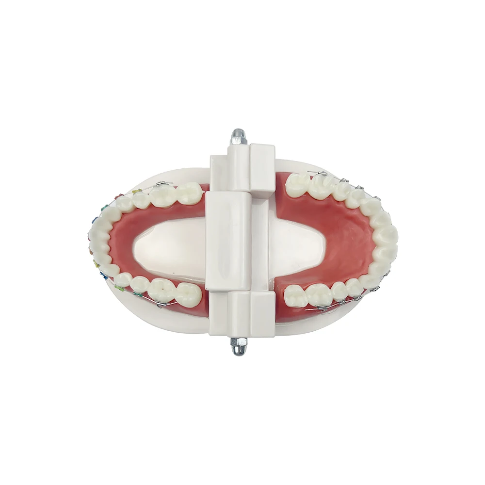 Orthodontic Teaching Model With Bracket Arch Wire Self-Ligating Metal Ligature Ties Standard Metal Brackets For Patient Demo