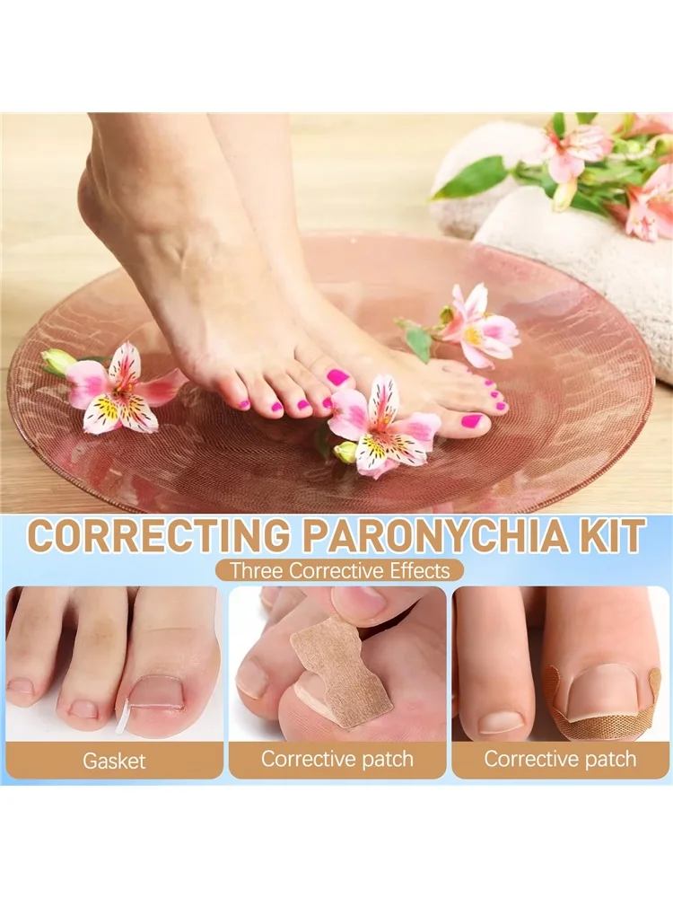 مجموعة مصحح أظافر القدم الغارزة مع شرائط تصحيح، مجموعة أدوات باديكير احترافية لأظافر القدم الغارزة، تصحيح أظافر القدم #4