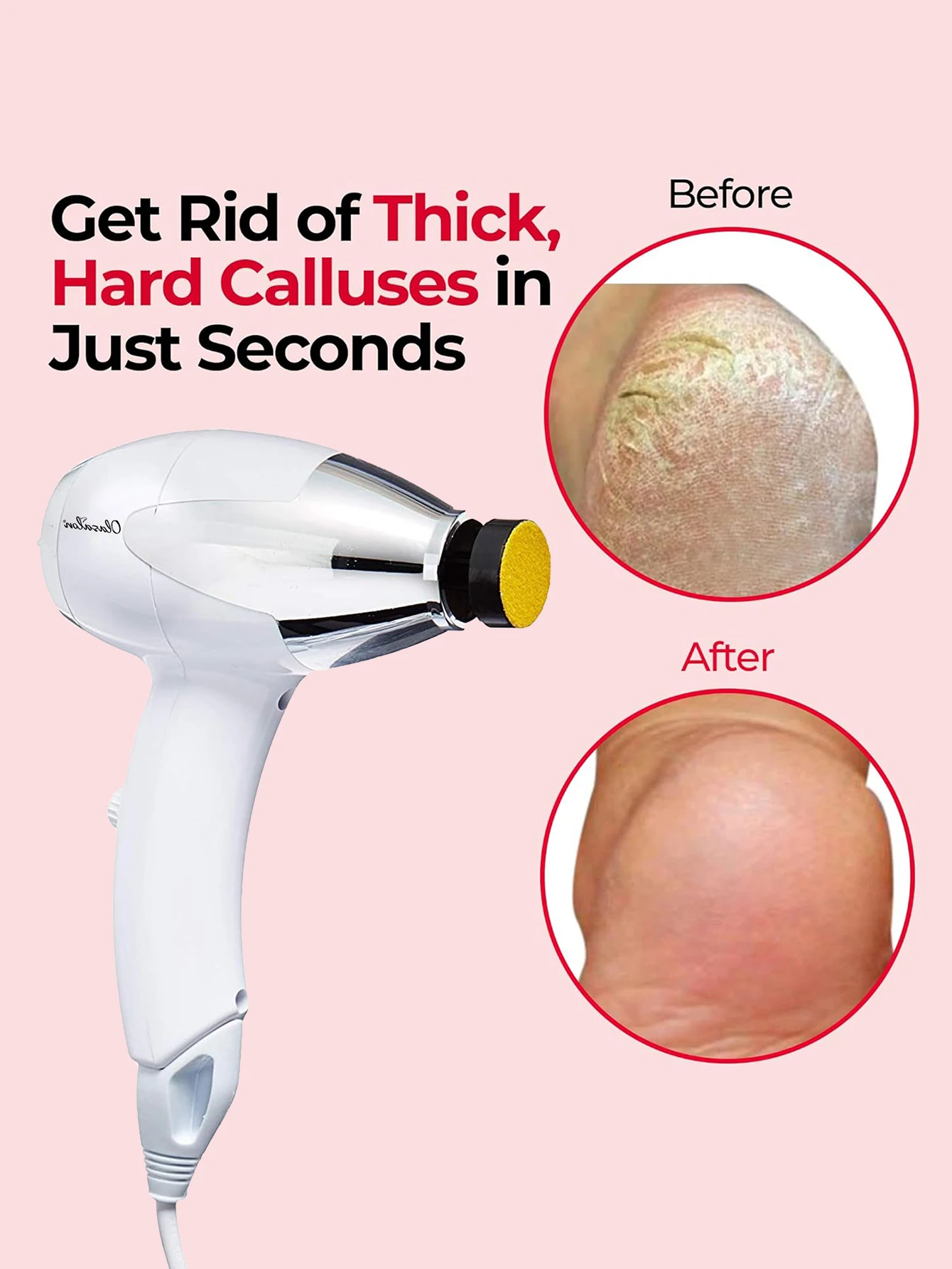 electric-foot-callus-remover-waterproof-foot-care-pedicure-tool-set-for-callus-removal-230v-european-plug