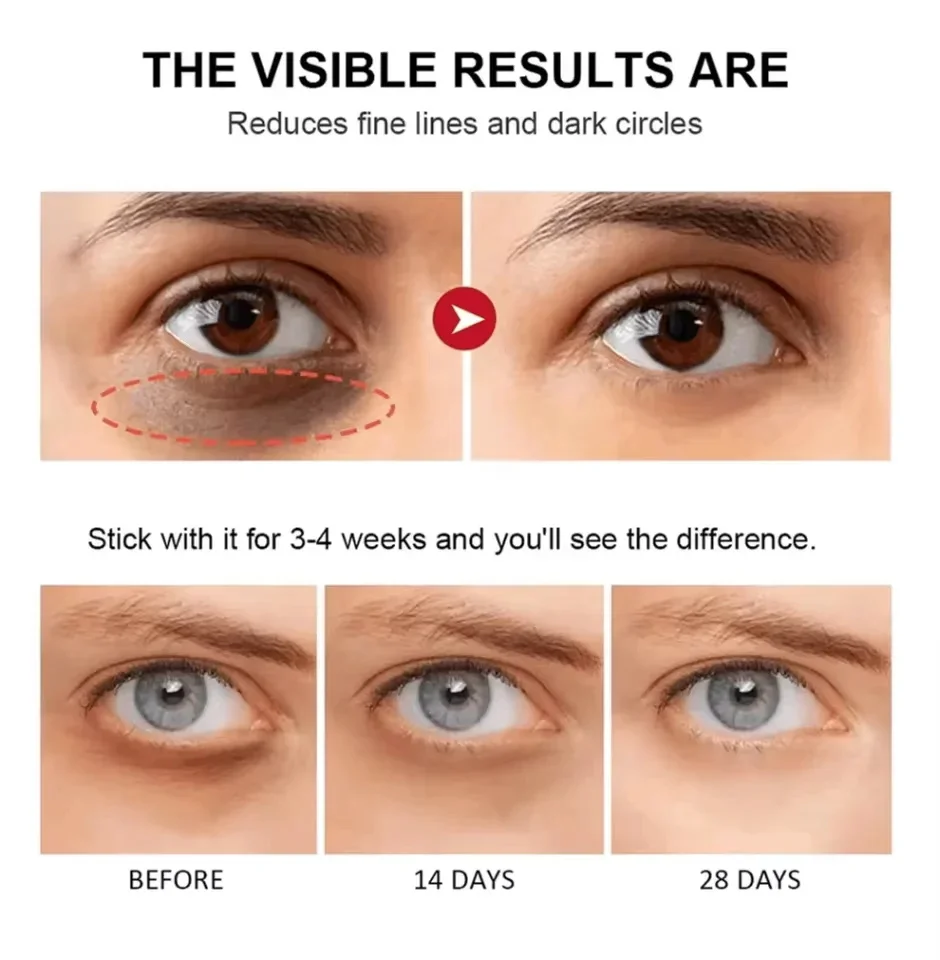 كريم إزالة حقيبة العين الفورية ريتينول المضاد للتجاعيد رفع ثبات تتلاشى الخطوط الدقيقة مكافحة الانتفاخ الدائرة الداكنة سطع العناية بالعين