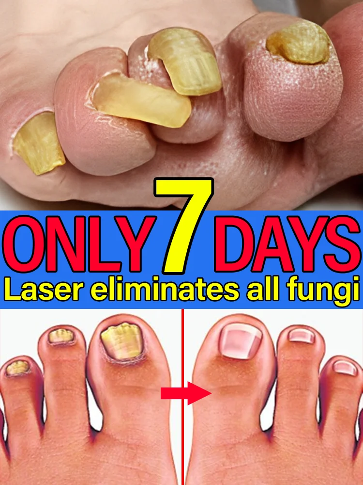 Hot Selling Laser Product For Solving Nail Problems