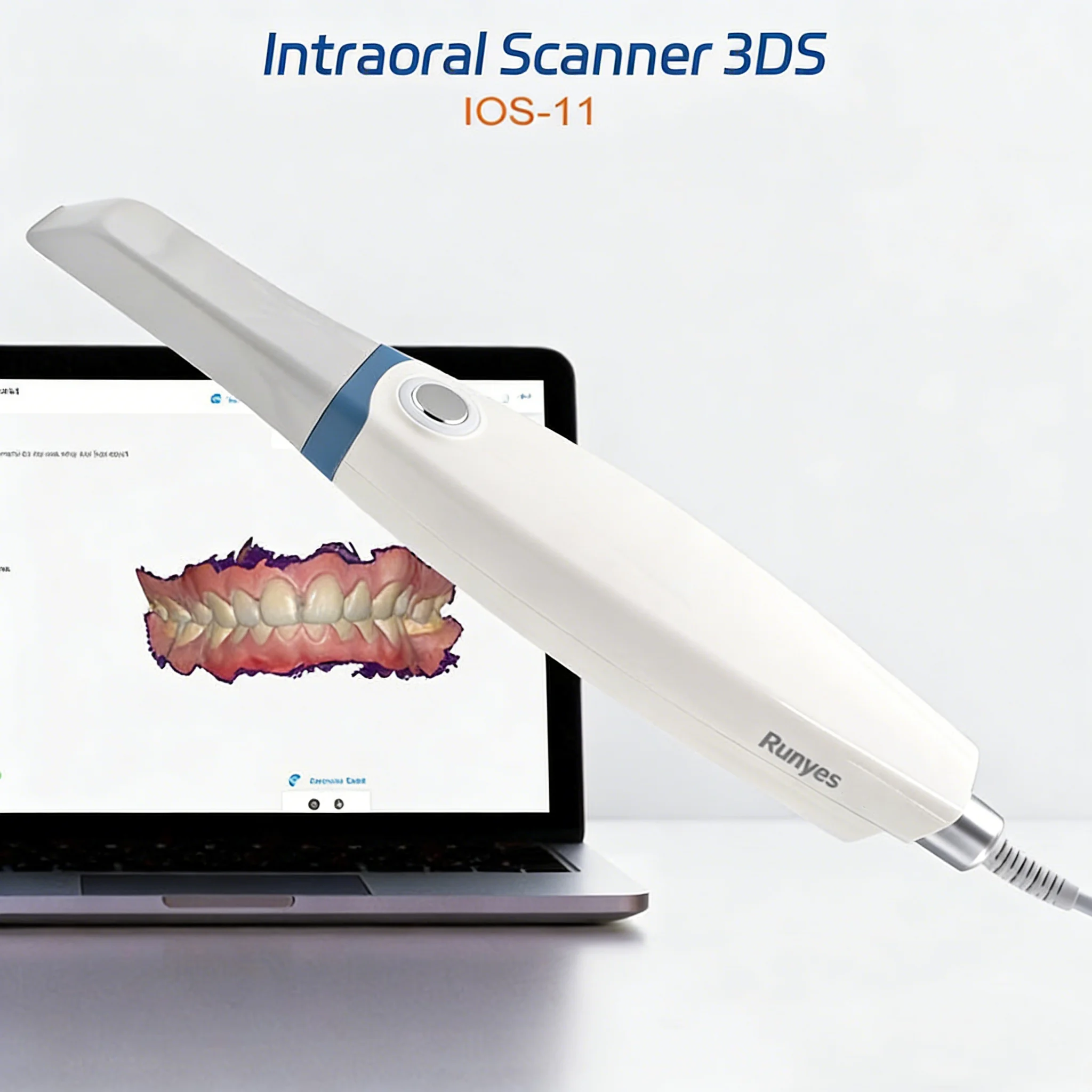 Dental Intraoral 3D Scanner Runyes V3 3.0 Pro, CMD CAD Orthodontic Restoration