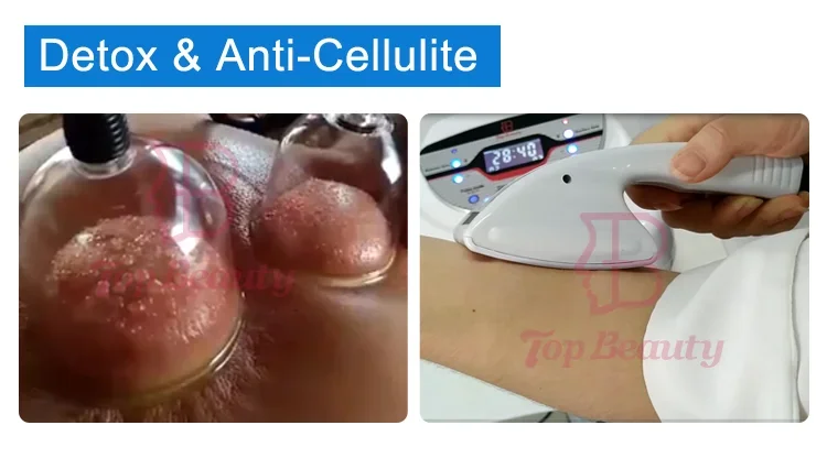 آلة رفع المؤخرة العلاجية Sp2 الاحترافية لتعزيز الثدي
