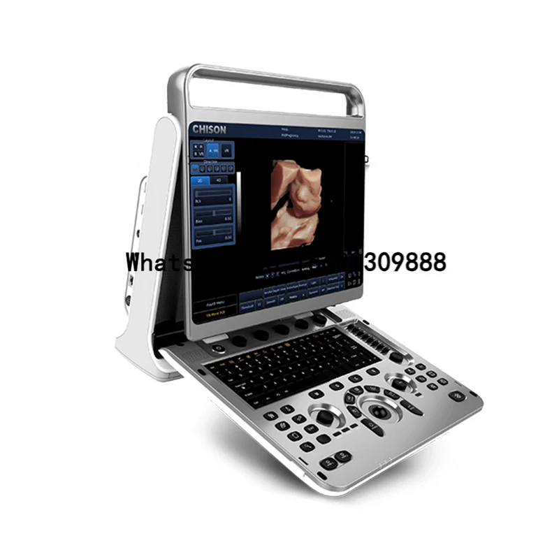 Chison Ebit 30 Lightweight Medical Ultrasound Instruments Portable Ultrasound Machine