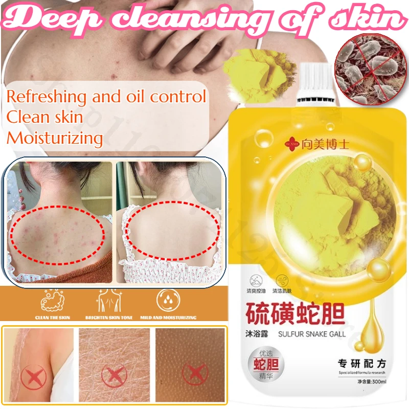 

Sulfur Snake Gall Soap Deep Cleansing Oil Control Mite Removal Acne Removal Hydrating and Moisturizing Shower Gel Whitening Skin