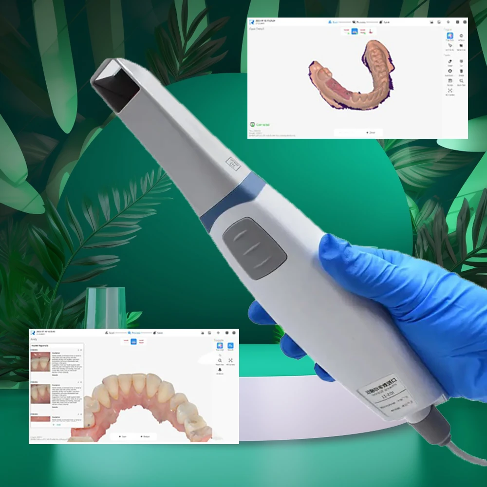 Scanner dentaire 3D, Instrument d'empreintes digitales, affichage en temps réel, Transmission d'image, outils de dentiste