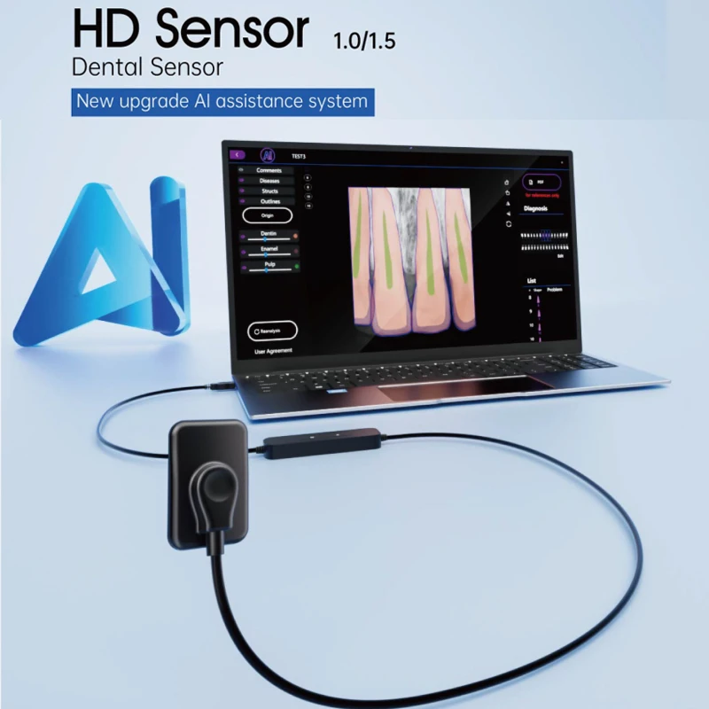 Sensore AI dentale Nuovo aggiornamento Sistema di assistenza Al Sensore HD, diagnosi intelligente, riconoscimento delle strutture, rilevamento delle carie