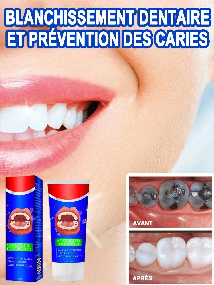 

Teeth Cleansing Whitening Mousse Whitening Teeth Remove tooth stains Clean mouth Fresh Breath Mousse Foam Portable toothpaste