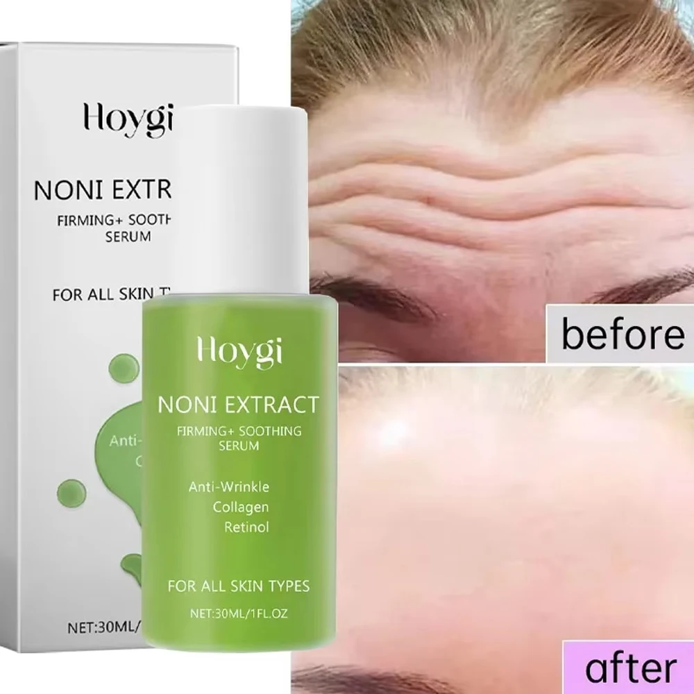 Noni Fruit Essence Noni Extract Energy Ampoule Face Serum Korean Anti-wrinkle Moisturizing Soothing Wrinkle Fine Line Skin Care