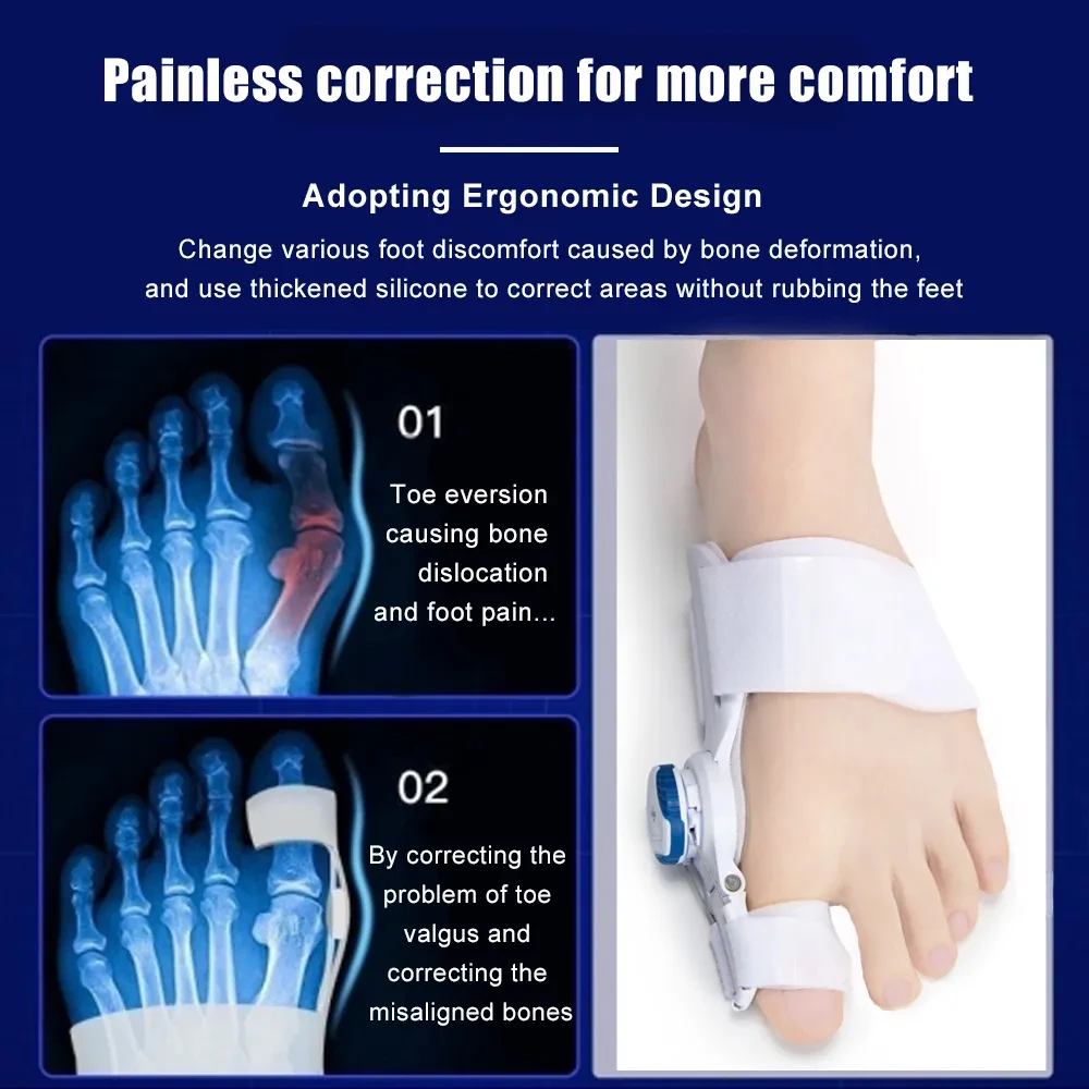 Orthopedisch Bunion Corrector Apparaat Voetverlichting Hallux Valgus Teen Correctie Pedicure Voeten Bot Duim Versteller Voet Massager