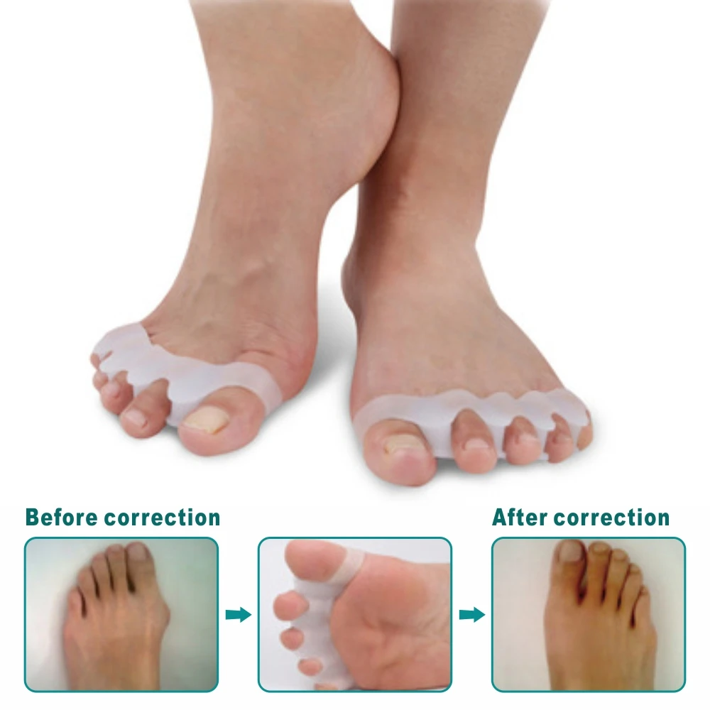 1 زوج لينة سيليكون الورم تو مصحح مسمار حامي العناية بالقدم هلام أداة العناية بالبشرة تو أروح فرد مفرشة