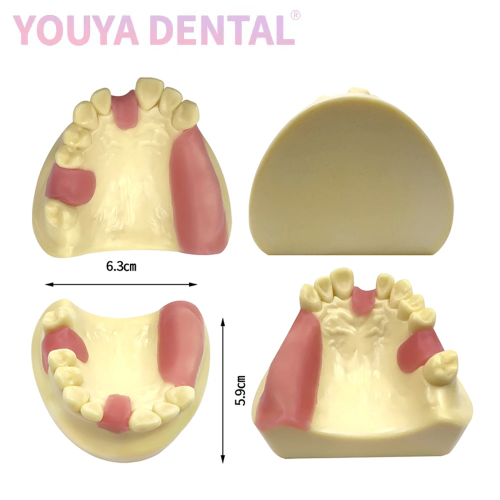 

Стоматологическая модель, ручная модель, Overdenture, демонстрация мягких десен, для обучения клинике