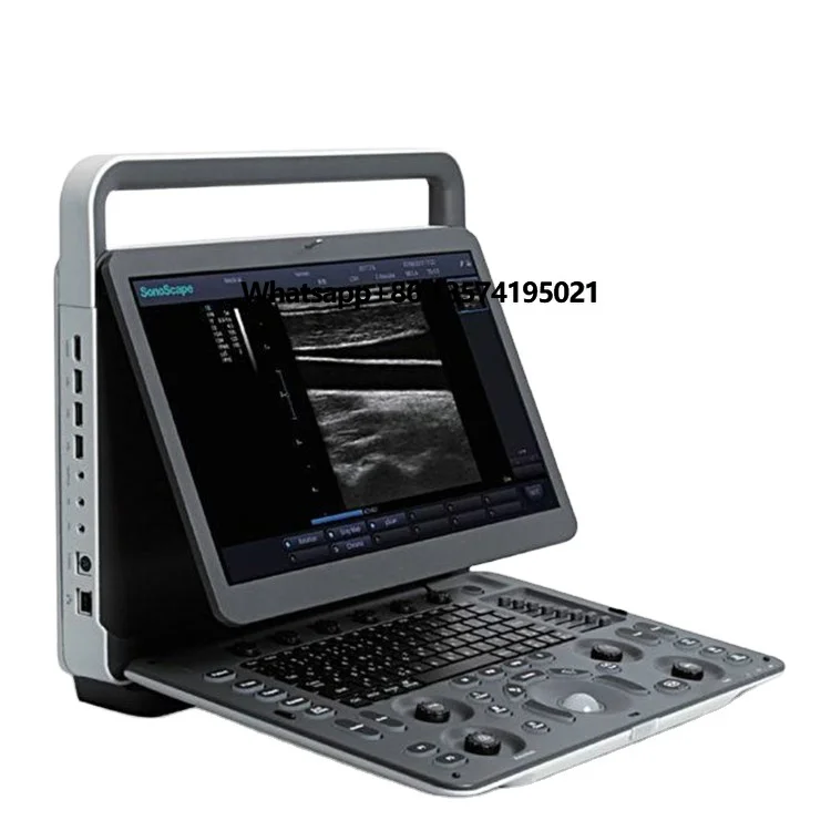 Sonoscape E1V Excellent Quality Animal Medical Portable Ultrasound Machine Price Veterinary Ultrasound 4d