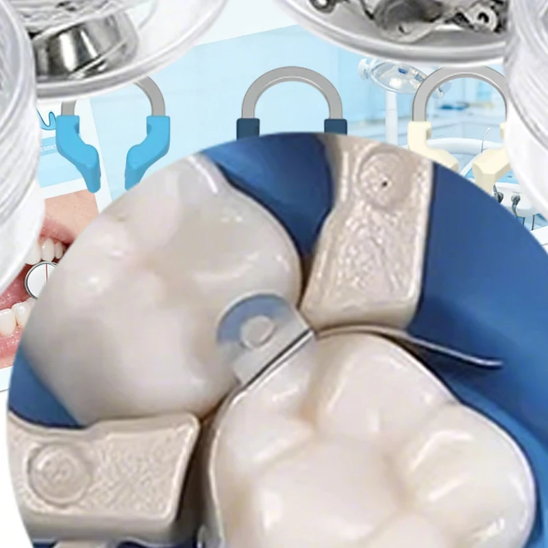 

Dental Sectional Matrix Bands System Universal Narrow Nickel Titanium Clamping Ring Dental Matrix Dentist Tools