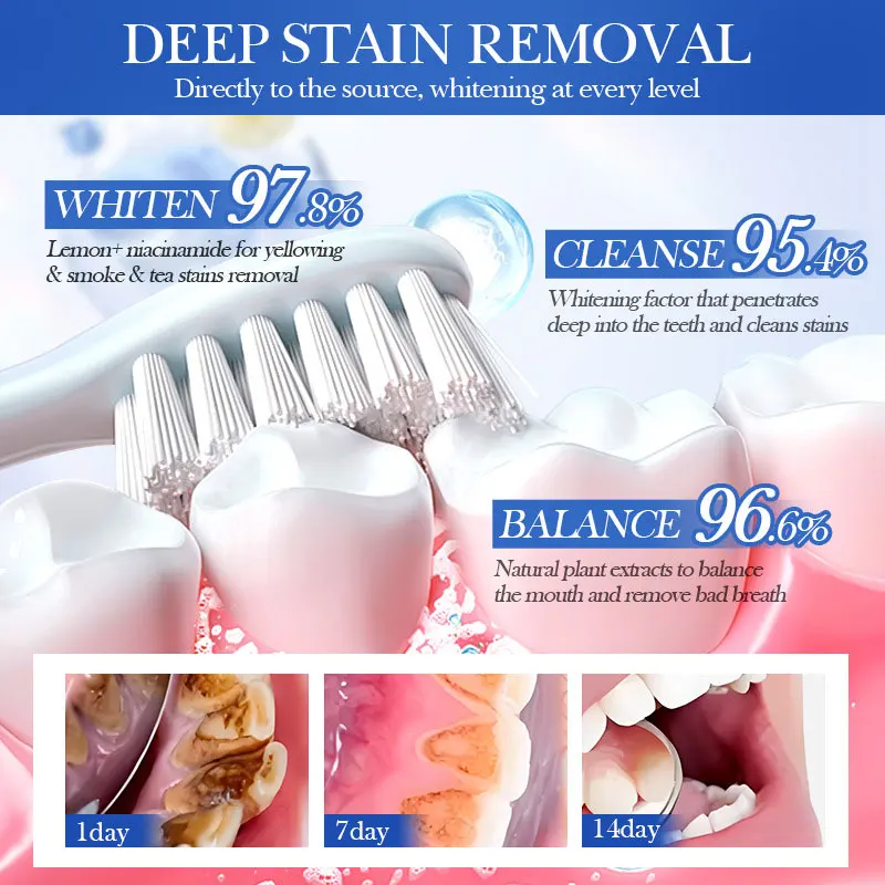 SADOER فاكهة الليمون والنعناع تفتيح البقع البيضاء والبقع نفسًا منعشًا يحسن العناية بالأسنان الصفراء #3