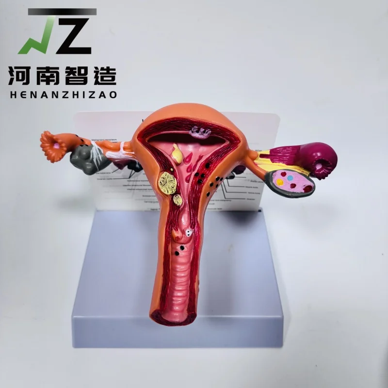 High quality female reproductive phantom model uterine model