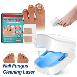 Outil Professionnel d'Assistance au Laser pour Champignons des Ongles, Lampe de Photothérapie UV, Chargement de Type-C, Vente en Gros