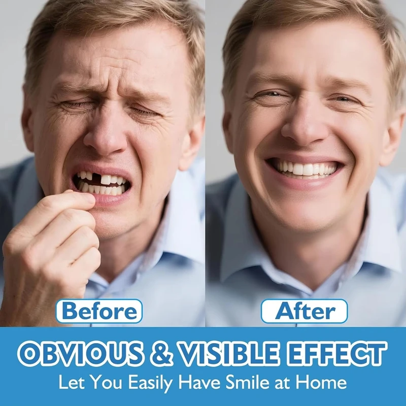 Thumbnail 4 - #61 Latest Denture Adhesives Updates