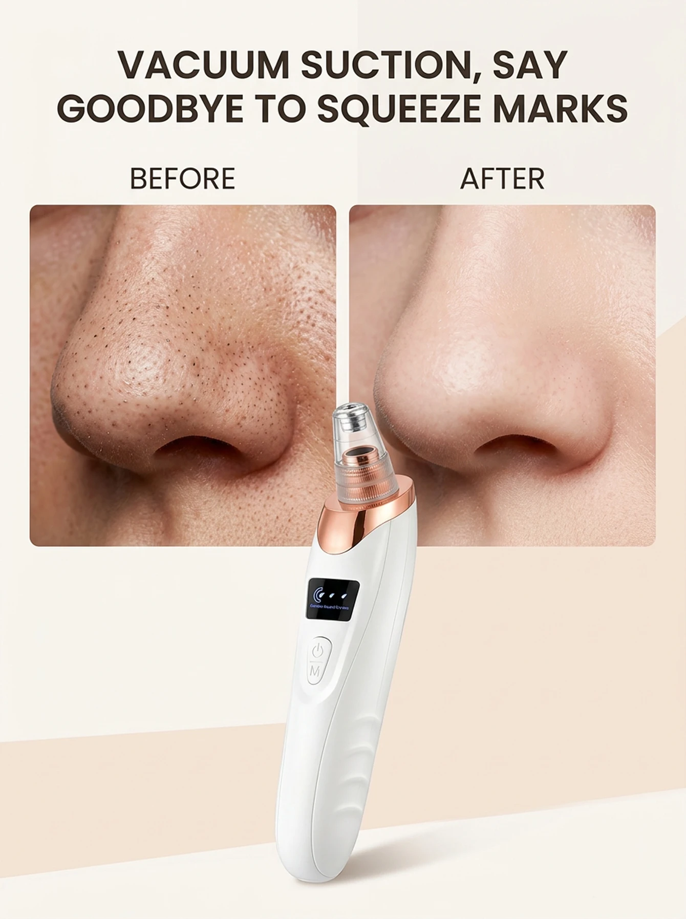 Thumbnail 2 - #55 Best Rated Skin Care Tools to Buy in 2026