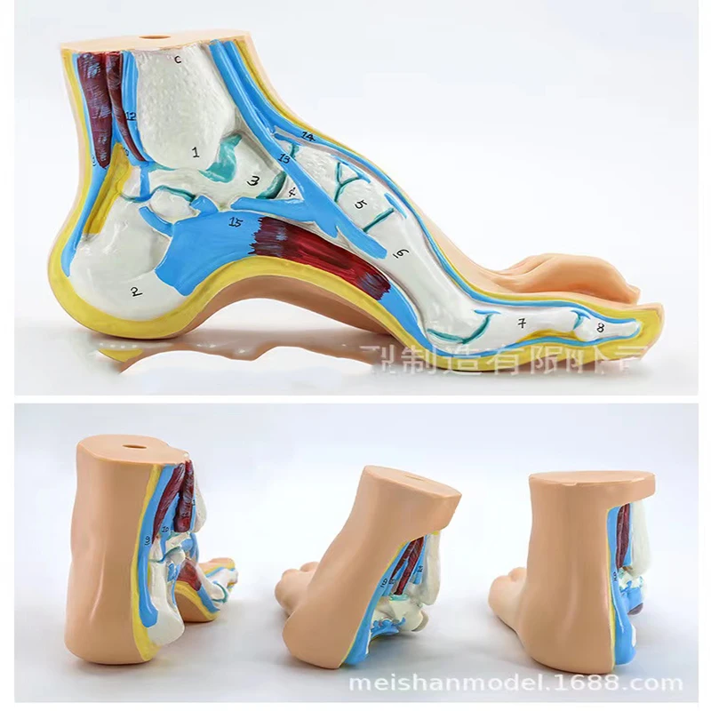 Human Foot Model Medical Teaching Anatomy Tool Human Foot Palm Muscle Model Arch Model Foot Anatomy Skeleton Flatfoot Anatomy