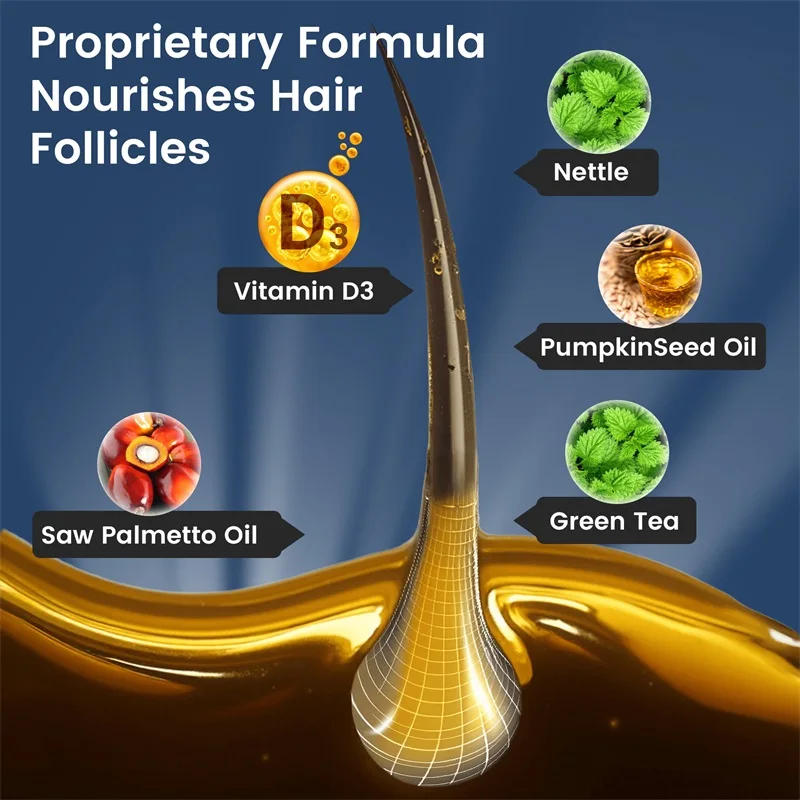 حاصرات DHT للرجال - تحتوي على المنشار بالميتو والبيوتين لتعزيز نمو الشعر الطبيعي وتغذية الشعر وتعزيز الامتصاص