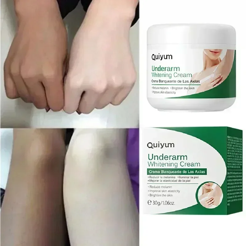 Caliente ~ eficaz mejorar el cuerpo crema blanqueadora axila piernas rodilla codo crema blanqueadora opaco eliminar manchas oscuras melanina iluminar la piel C