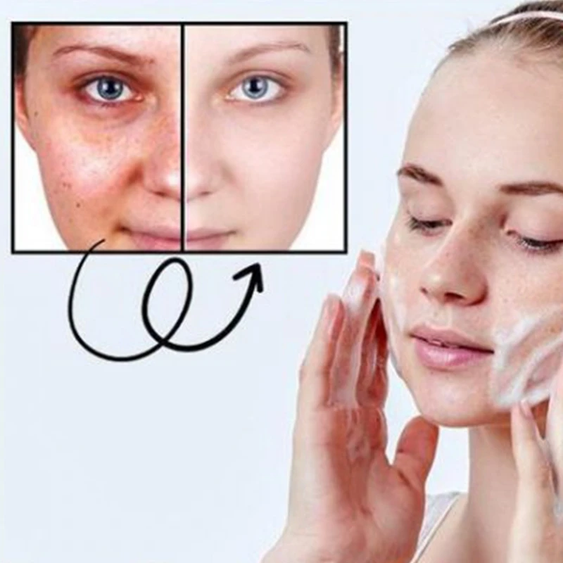 สบู่กาแฟลดน้ำหนักด้วยดินเหนียวภูเขาไฟขนาด60กรัมพร้อมสติ๊กเกอร์สะดือทำให้ผิวกำจัดเซลลูไลท์ขาวกระจ่างใส