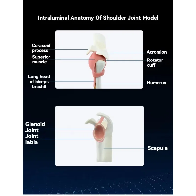 

2025 hot sale KyrenMed Shoulder Surgery Simulation Model with Bench Vise Clamp for Dry Models Shoulder Surgery Train