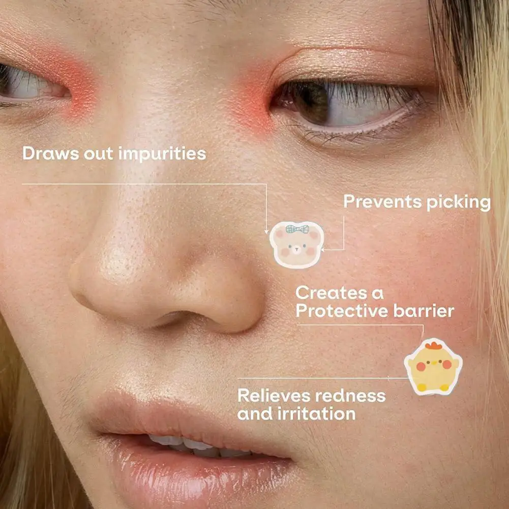 100 قطعة من ملصقات البثور الكرتونية على شكل الدب لإزالة حب الشباب من البولي إيثيلين خفيفة الوزن ومريحة للتنفس أداة العناية ببشرة الوجه