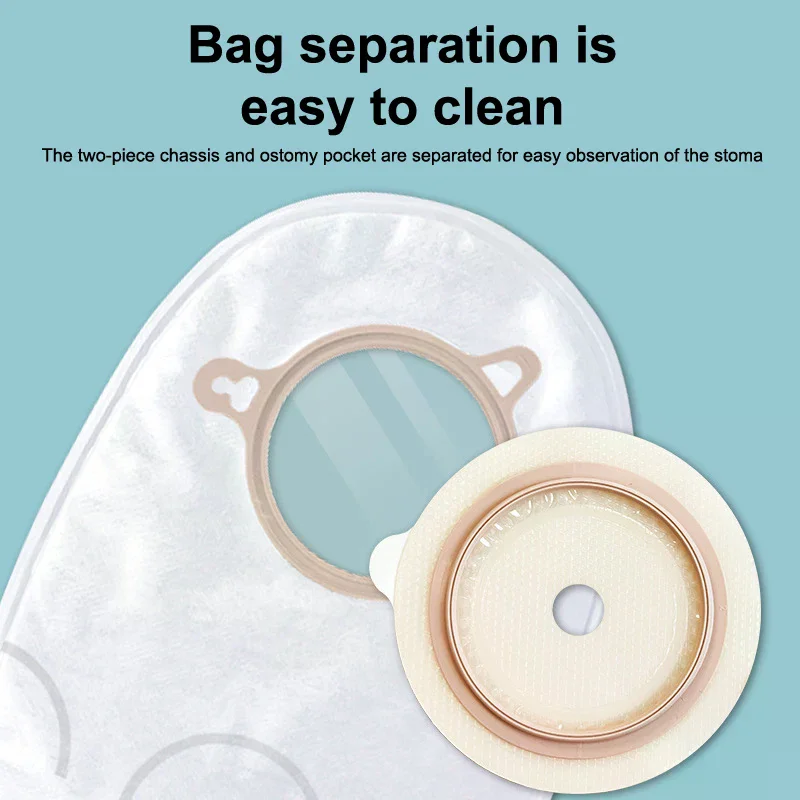 Bolsa de Ostomía de Dos Piezas No Tejida con Gancho y Válvula de Urinación, Suministros Desechables para Bolsas de Colostomía, Cuidado de Estomas Ileostomía