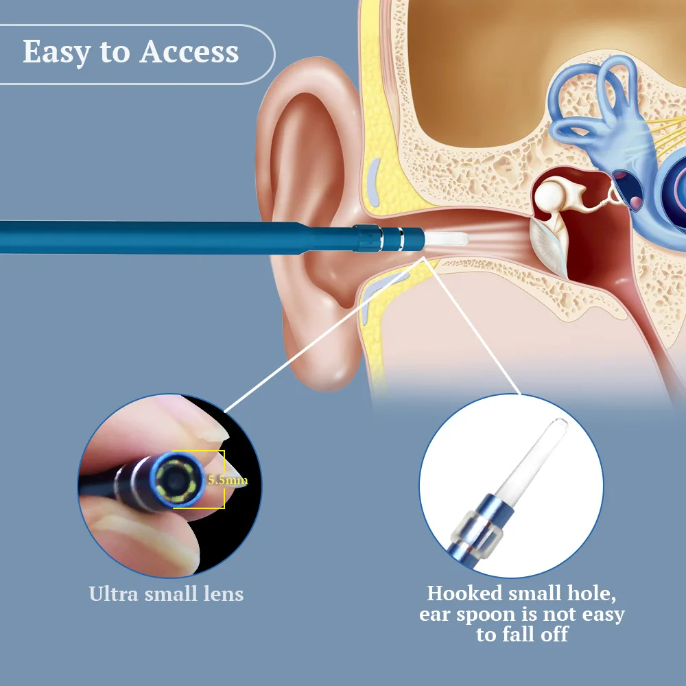 Endoscópio Ear Picker Earpick, 3 em 1, Visual, Tipo-C, USB, Otoscópio, Kit de Ferramentas de Remoção de Cera, Earpick, Câmera Visual, Assistência Médica, 480P