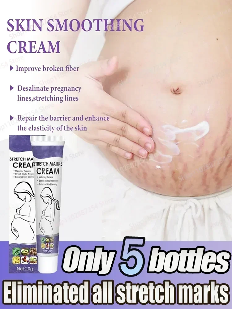 

Scar Repair Cream Anti Aging Maternity Skin Repair Remove Pregnancy Surgical Scars Treatment Body Skin Care Cream 1006