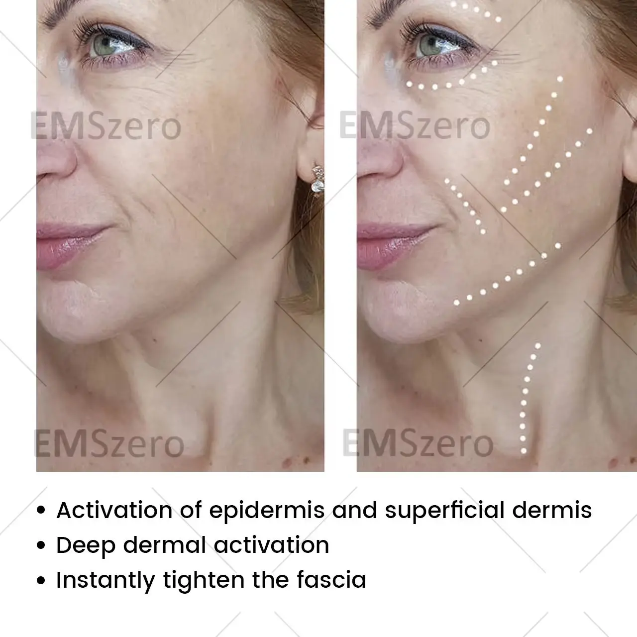 7D 12D TT Anti Aging Machine Facial Skin Tightening MachineFacial Skin Care Professional Commercial Equipment