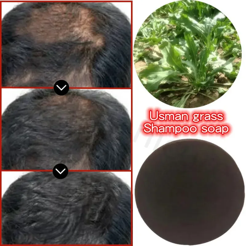 Usma Grass Soap Nourishes Hair Roots Anti-hair Loss Oil Control Eyebrow Growth Soap Shampoo Soap Improve Thinning Hair