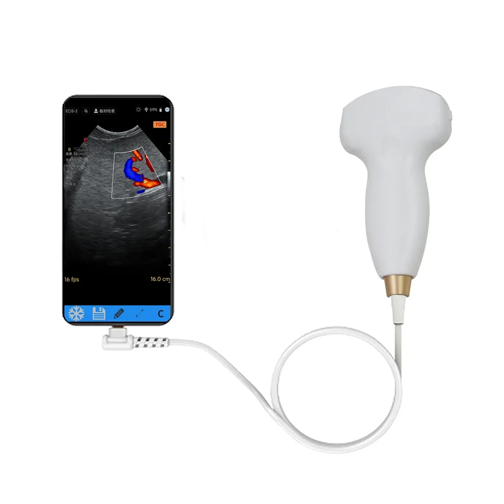 Mobile Phone Tablet Electronic Convex Probe Veterinary Ultrasound Machine New Digital Ultrasonic Diagnostic System