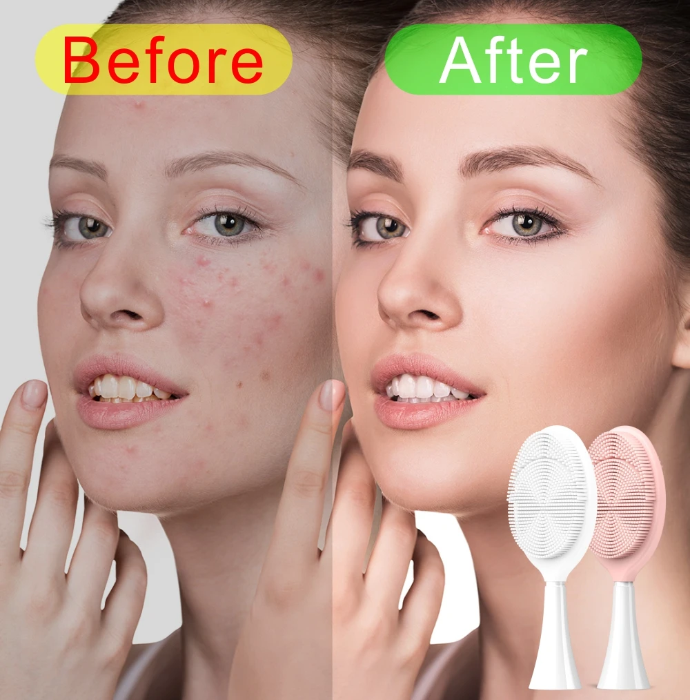 Szczotka do czyszczenia twarzy głowa BH401 wymiana silikonowe pory kurczące czysta skóra złuszczająca kąpiel elektryczne głowice do szczoteczek do zębów