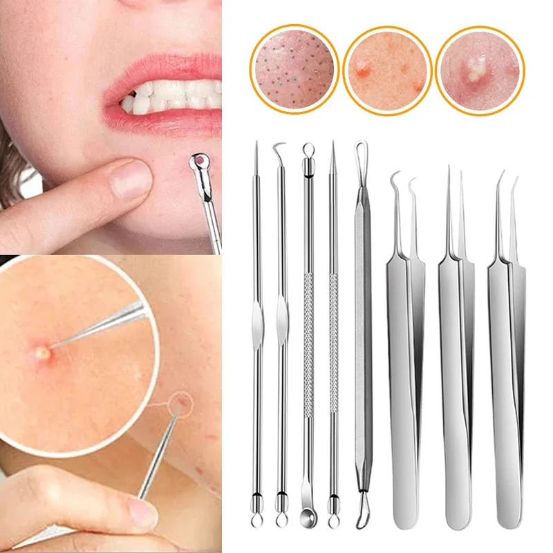 8Pcs Super Friday Stainless Steel Blackhead Comedone Acne Blemish Extractor Remove Face For Skin Needle Remove Care Cleaner Tool